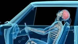 Herniated and Bulging Disc Settlements After a Georgia Car Accident