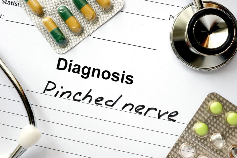 Pinched Nerve from a Car Accident: Causes, Symptoms, Diagnosis, and Treatment