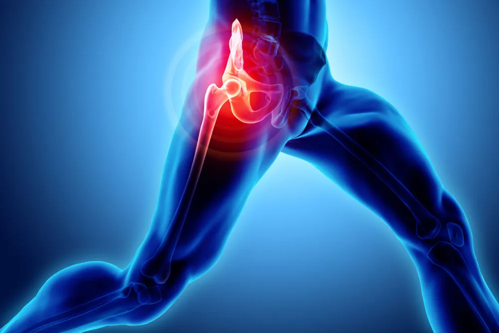 Hip Pain After a Car Accident