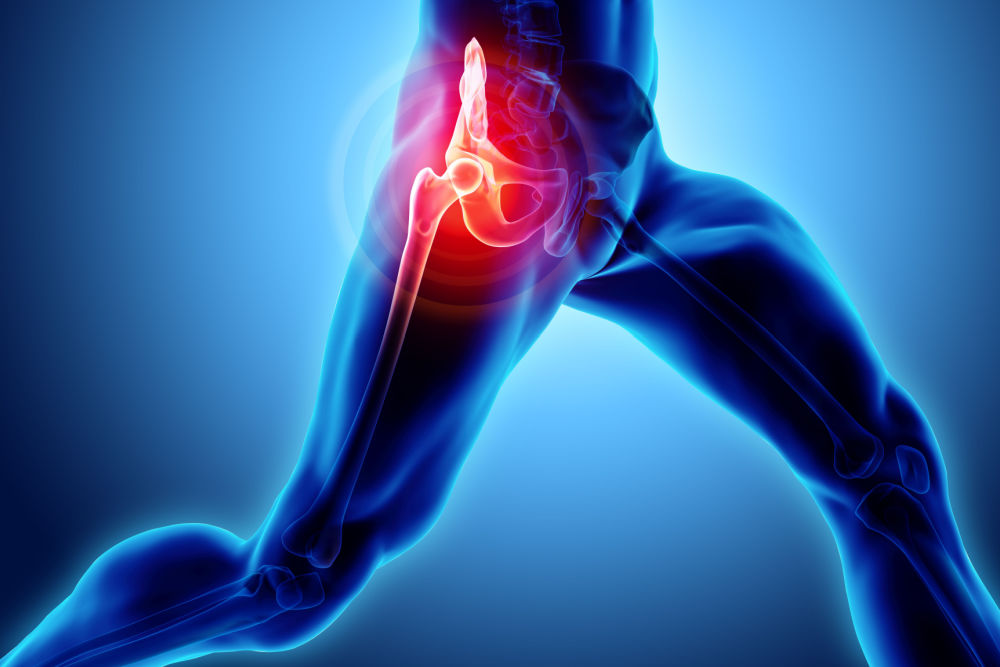 Knee Injury From Car Accident: Treatment and Legal Options